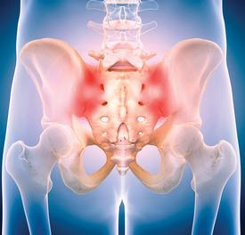 Sacroiliac joint pain. Spinal Surgeon in Liverpool and Wirral.